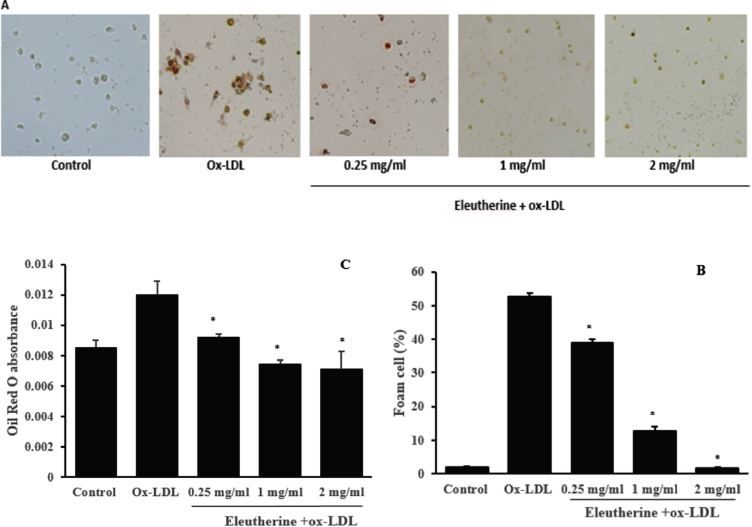 Anti Atherosclerotic Activity Of N Hexane Extract Of Eleutherine Americana Merr On Human Macrophage Primary Cell Culture